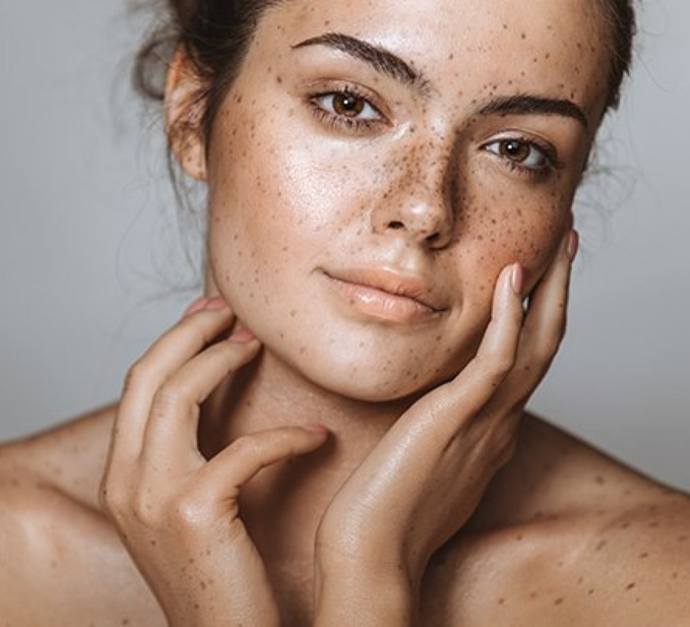 Melasma treatment